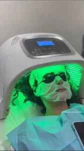 Discover PDRN treatment in DHA Lahore for skin rejuvenation, repair, texture and glow at Skin Perfection Centre. Explore PDRN microneedling and nano infusion.