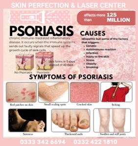 Psoriasis Causes and Treatment | Dr. Sommiya Anum