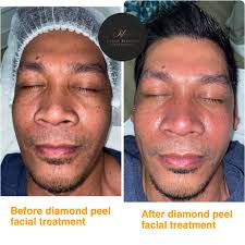 Why Does Skin Ageing Happen?